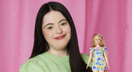 Jente med Downs syndrom held ei Barbie-dukke med Downs syndrom